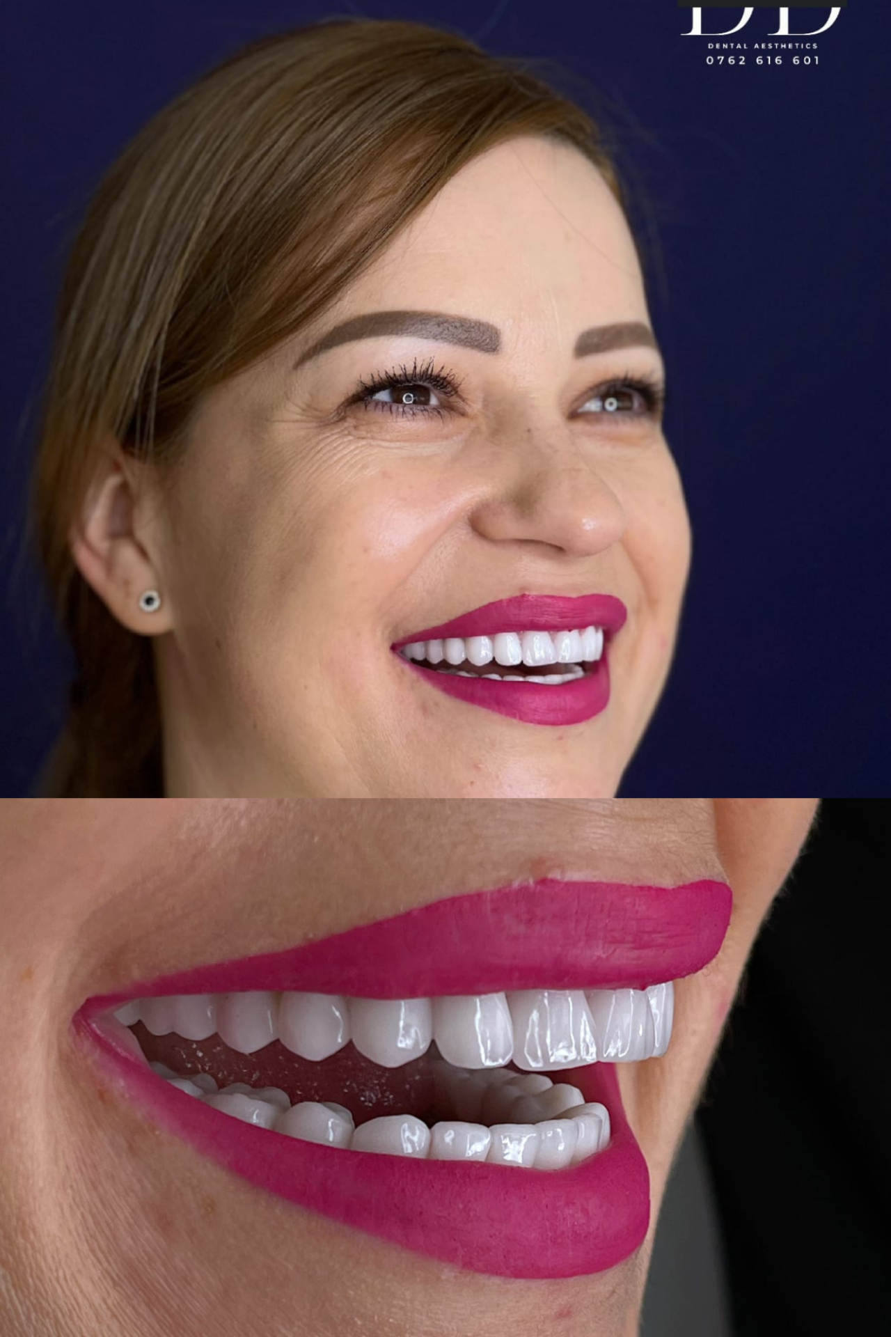 Untitled design (55)