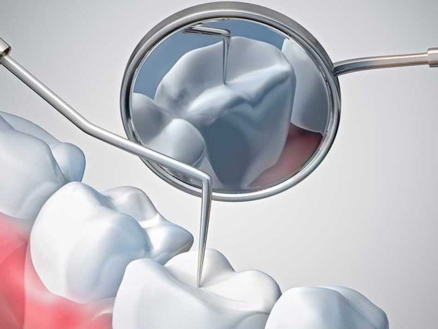 profilaxie-iasi-bionica-profile https://dentistdana.codingforum.ro/wp-content/uploads/2025/04/profilaxie-iasi-bionica-profile-640x480.jpg